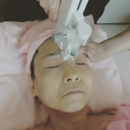 【エステ版水光注射】眉間の縦ジワや額の横ジワが気になる方にもおすすめ☆の記事動画