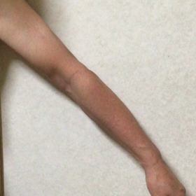 腕から手首の動きの画像