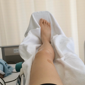 ACL入院生活: 術後6日目の画像