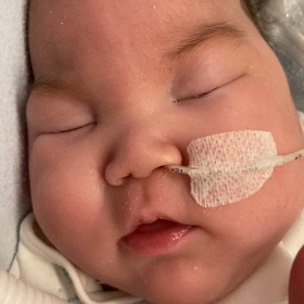 けいれん が心配な保護者さまへ 一つの考え方としてご紹介 超低出生体重児あおくんの記録