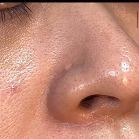 毛穴の大掃除！初回体験にきてくれました♡の画像