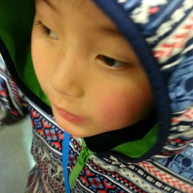 チビスケ☆肝機能検査、完結！！の画像