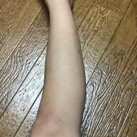 11月よりプチ脱毛メニュー始めます♡の画像