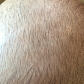 頭の真ん中が、ペコペコ動く。の画像