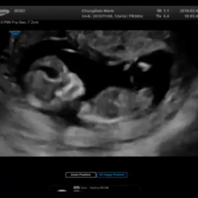 ○○○ご報告♡○○○の画像