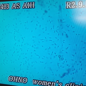 人工受精の画像