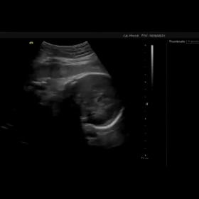 第二子妊娠記録～8ヶ月～の画像