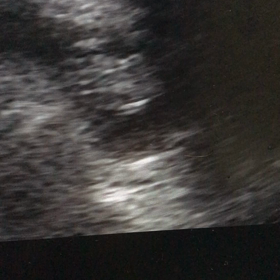 エコー動画　8w4dの画像