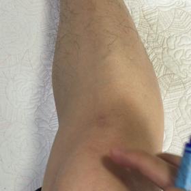 痰きりのツボ！の画像