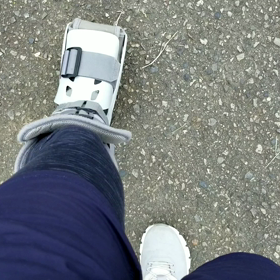 アキレス腱断裂～再リハビリ.14の画像