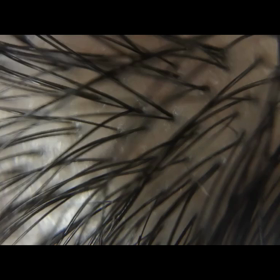 頭皮ケアメニューの画像