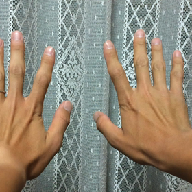 第5回・体操スクール！の画像