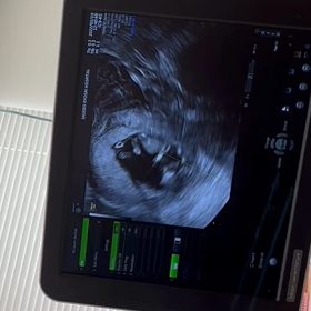 「泣いた」のアメ限公開の画像