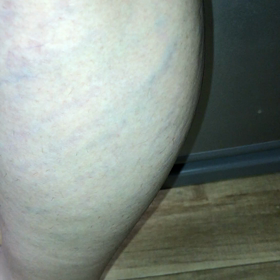 まだ続いてるの画像