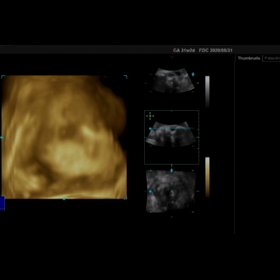 第二子妊娠記録～8ヶ月②～の画像