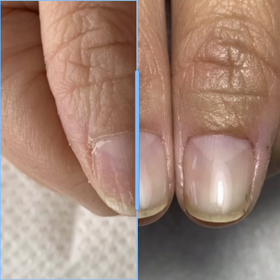 爪は変わるっ！！！の画像