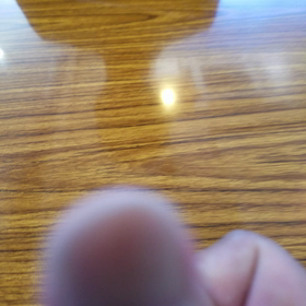 ギランバレー症候群⑫～ミギー？～の画像