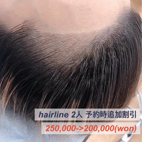 (韓国)ヘアライン2人同時施術、現金価格の追加割引の画像