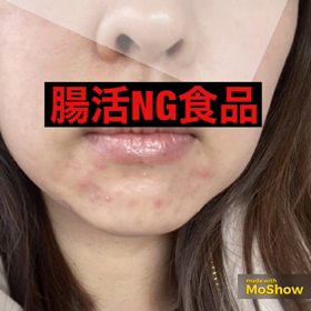 あなたの腸活、本当に合っていますか❓の画像