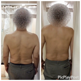 交通事故の症状でお困りの方阪急高槻市徒歩4分のリメイク整骨院への画像