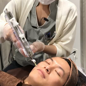 水光注射-フレンチショット-のご紹介　Zetith Beauty Clinicの画像