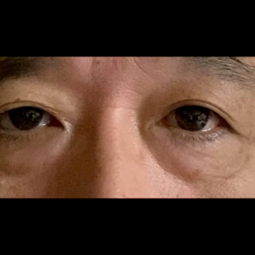 目のあたりの動きの画像