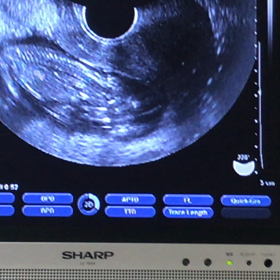 どっひゃー〜〜〜〜〜〜の画像