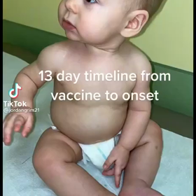 元気でかわいい男の子が１３日目に突然、病にそして人工呼吸器に繋がれて。の画像