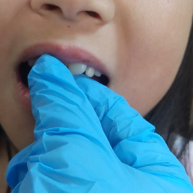 無事抜けましたの画像