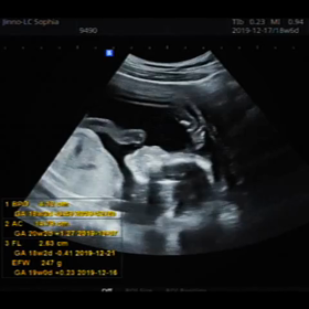 持ち越し。の画像