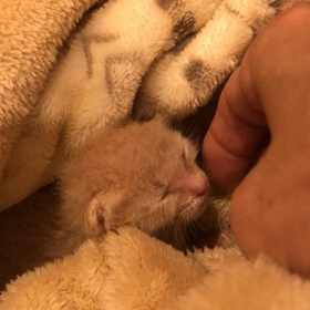 未来くん（漏斗胸)の画像