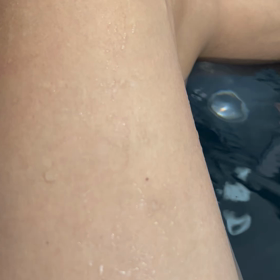 筋肉のピクつき②太ももの画像