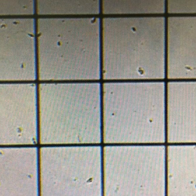 47歳　男性不妊の鍼灸の効果の画像