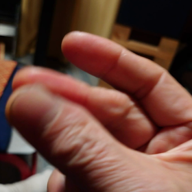 お手手はシワだらけの画像