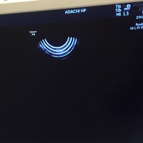 10w3d エコー動画の画像