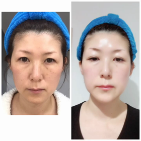 老化をあきらめていませんか？の画像