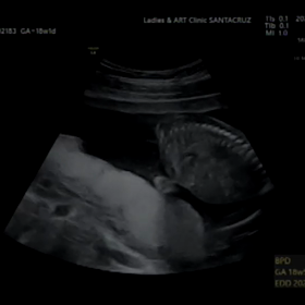 18週目の妊婦健診の画像