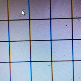 福島県白河市の鍼灸院　男性不妊への鍼灸の効果の画像