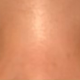 二重切開　5年と7ヶ月(動画あり)の画像