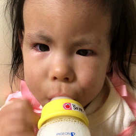 発作とミルクの状況の画像