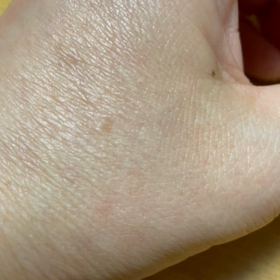 付随運動が止まらないの画像