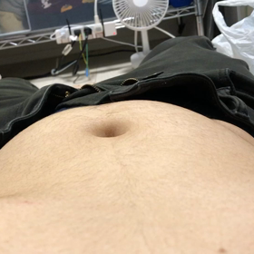 お腹の様子がおかしいの画像