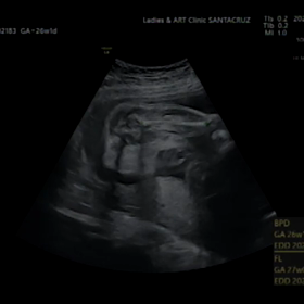 転院前の最後26週目の妊婦検診の画像