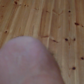 膝が欠陥住宅の画像