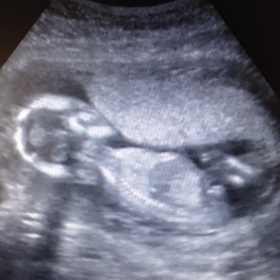 15w1d 妊婦検診(エコー動画あり)の画像