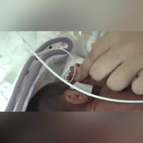 生後12日目 修正27週4日の画像