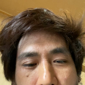 心眼際で訴え成立の画像