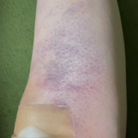 痛すぎるの画像