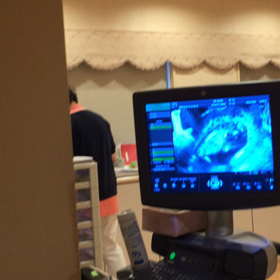 12w5d妊婦健診！の画像