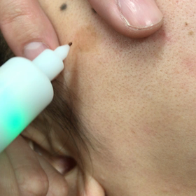 お客様でシミに悩んでる人が10人いたらコレ☆の画像